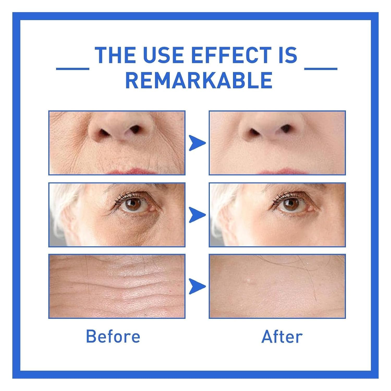 Serum Soforteffekt Gesicht, Anti-Aging Serum, Face Serum, Gesichtsserum, Olavita Serum, Kollagenverstärkendes Anti-Aging-Serum Für Alle Hauttypen (4 Stück)