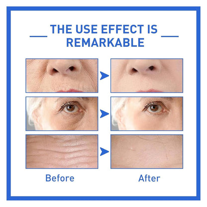 Serum Soforteffekt Gesicht, Anti-Aging Serum, Face Serum, Gesichtsserum, Olavita Serum, Kollagenverstärkendes Anti-Aging-Serum Für Alle Hauttypen (4 Stück)