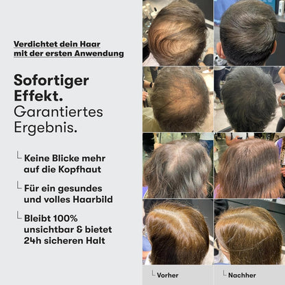 Streuhaar Zur Haarverdichtung - Für Scheitel, Kahle Stellen Am Ober- Und Hinterkopf - Von Führenden Salons Empfohlen - 11 Farben - Widerstandsfähige Streuhaare (Hellblond)