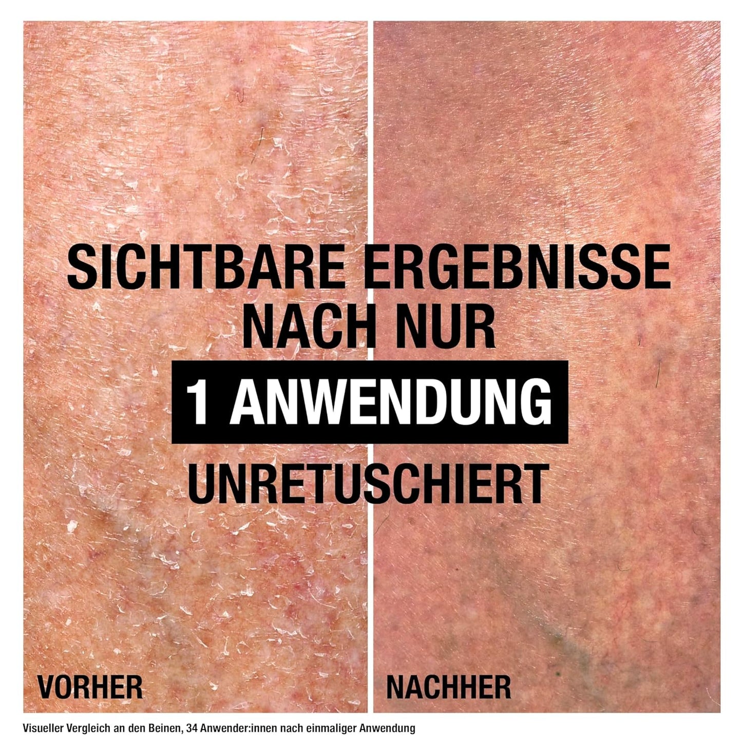 Neutrogena Norwegische Formel Intense Repair Reparierender CICA Bodybalsam 250 Ml Körperlotion Für Eine Sofortige Linderung Und Mehr Feuchtigkeit Bei Sehr Trockener, Rauer Haut